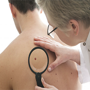 before and after treatment