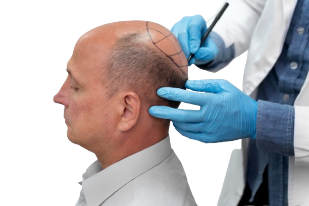 before and after treatment